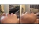 ツキミ コスメティックス(TSUKIMI cosmetics)の写真/口腔ケアでほうれい線予防を!気になるたるみや口の開けづらさを心地よくケア♪
