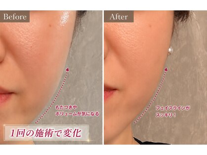 リフト 静岡(Lift)の写真