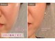 リフト 静岡(Lift)の写真