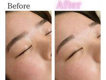 イーサム(e-sam)/美眉WAX脱毛