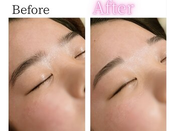 イーサム(e-sam)/美眉WAX脱毛