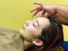 西川口みんなの鍼灸整骨院/目元・口元のお悩みにアプローチ