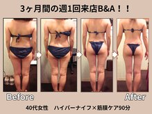 リライブ 亀有店(Re:Lives)の雰囲気（ハイパーナイフ痩身&小顔で40代～からの理想のボディを実現♪）