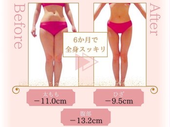 ピュアエステブリアント 銀座店/お客様の結果［銀座/痩身］