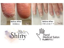当店は全てのメニューケア付き!フットは角質除去もついてきます!