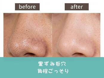 ココミエレ(COCO MIELE)/いちご鼻毛穴ケア