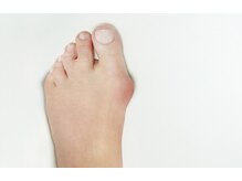 ミヤビ(MIYABI)/指のお困りにインソール