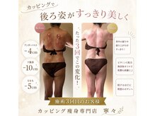寧々/気になる首の付け根