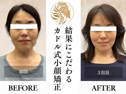 カドル 福岡天神店(KADORU)の写真