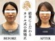 カドル 福岡天神店(KADORU)の写真