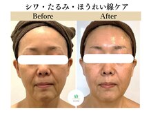 ミューズ 成城(MUSE)の雰囲気（40代からのエイジングケアNO.1【シミ/しわ/たるみケア】肌質改善）