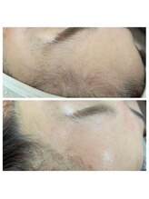 爪屋べっぴん堂/