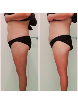 アズ(AZU)/40代女性before After‐