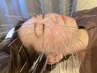 美容ルート鍼 60分