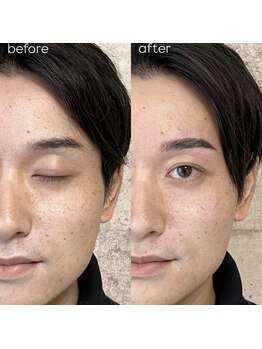 アイリー(IRIE)/【MENS】ハリウッドブロウリフト