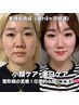 【圧倒的小顔ケア】お顔の筋トレ/中顔面短縮/美顔筋育成/通常¥19.800→¥6.600