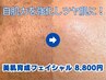 シミ、シワ、たるみ等の年齢肌にお悩みの方！【美肌育成フェイシャル】