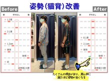 篠丸接骨院/◎猫背改善◎