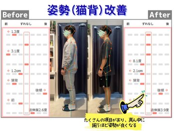 篠丸接骨院/◎猫背改善◎