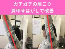 鍼灸整骨院やわら/