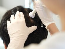 フォンビューティー(fon beauty)/エステだから叶う最先端育毛促進