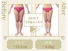 ピュアエステブリアント 銀座店/お客様の結果［銀座/痩身］