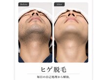 スオ(SUO.)の雰囲気(毎朝のヒゲ剃りから解放へ清潔感アップを目指すヒゲ脱毛です人 )