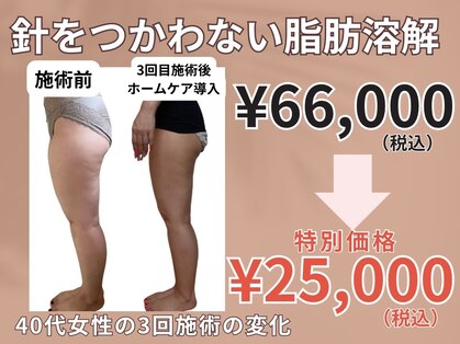 ページミューの写真