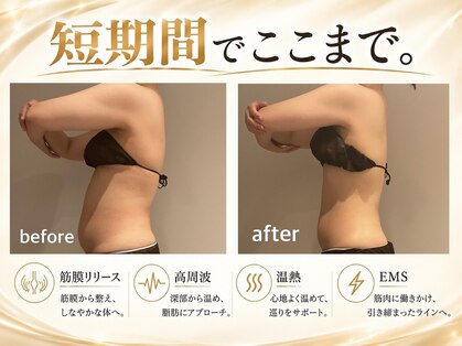 エステティック ミュー(Esthetic MiEUX)の写真
