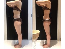 リボディ 表参道(An re Body)/before→after