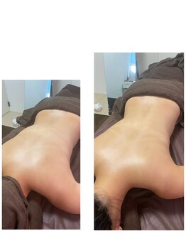 クッカ(kukka)/お背中陶肌トリートメント☆