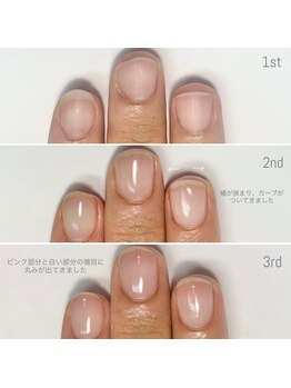 リモネイル(Rimo nail)/美爪育成・深爪改善