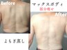 【痩身/選べる部位痩せ】よもぎ蒸し×マックスボディ
