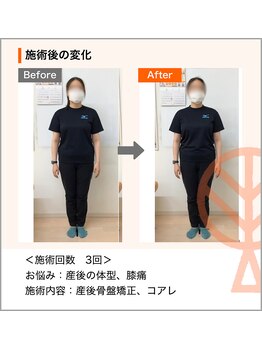 ただき接骨院 整体院 新前橋院/ お悩み：産後の体型崩れ、膝痛