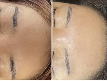 ラヴィ(Ravi)/ハリ、ツヤアップ