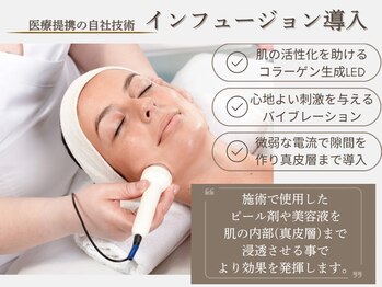 ベルスタイル(Bell style)/インフュージョン導入とは