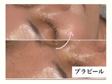 ビジュー(BIJOU)/プラピール