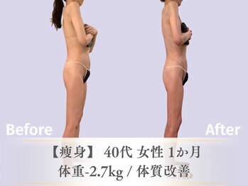 ベルペール(Belle perle)/痩身|デトックス×インドエステ