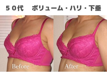 バストサロン メルベイユ(Merveile)/位置UPでふっくらボリュームUP