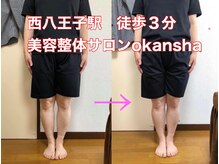 美容整体サロン オオカンシャ(okansha)/美脚☆