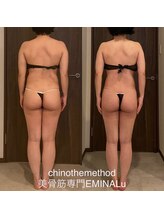 エミナル(EMINALu)/もっこり肩甲骨解消
