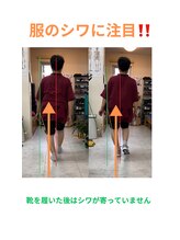 ナカザワ(NAKAZAWA)/股関節が痛い・3