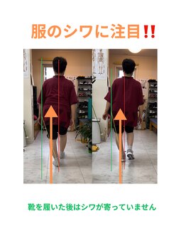 ナカザワ(NAKAZAWA)/股関節が痛い・3