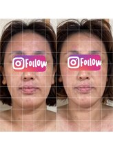 セブンドロップス(7drops)/小顔効果抜群！