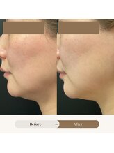 ラディアント 吉祥寺/すっきりフェイスライン