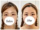 ウニカ(Unica)の写真