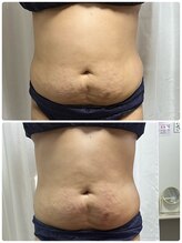 アスピリア(aspirer a')/本格痩身で理想のスタイルへ‥