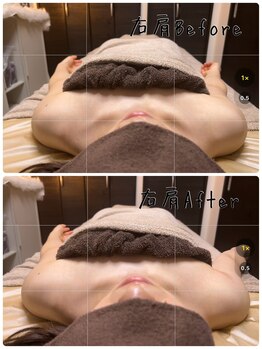 フィール(feel)/Before/After 整体+リンパ