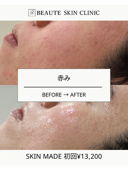 ボーテスキンクリニック/スキンメイド【TROIAREUKE】