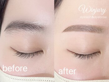 ウィンジュリー(Winjury)/眉毛ワックス